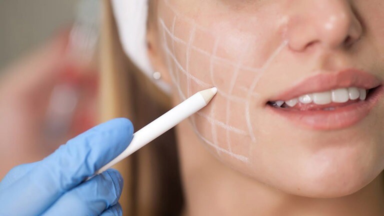 Hút mỡ mặt cũng có những rủi ro tiềm ẩn mà phái đẹp cần chú ý.