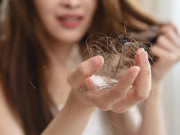 Đẹp - 4 nguyên nhân phổ biến khiến vuốt nhẹ tóc cũng rụng cả nắm