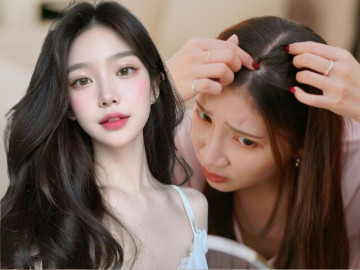 Đẹp - Tóc rụng liên tục, ngày càng mỏng, chuyên gia bật mí 10 thói quen “cứu nguy” giúp tóc con mọc lên tua tủa