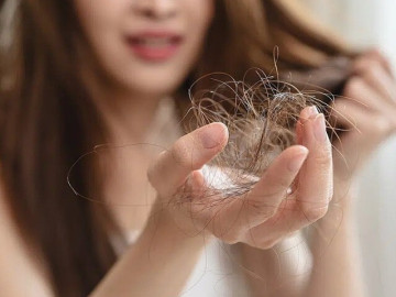 4 nguyên nhân phổ biến khiến vuốt nhẹ tóc cũng rụng cả nắm