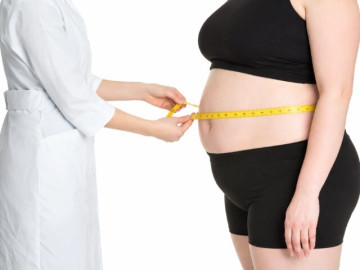 Chuyên gia chỉ ra 3 kiểu béo phì và cách giảm mỡ hiệu quả