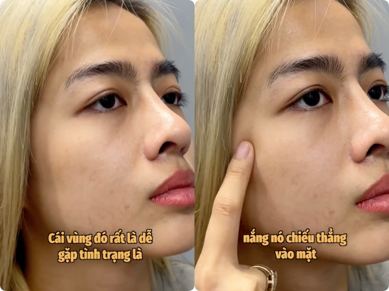 Tuyệt chiêu bôi kem chống nắng “2 lớp” của KOC Quỳnh Như Nguyễn: Tại sao vùng gò má cần được bảo vệ gấp đôi? - 3