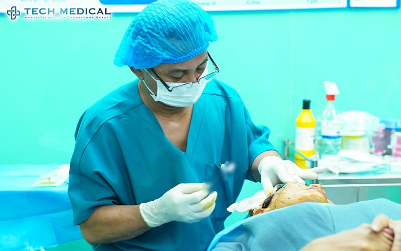 Thắt cơ vi điểm, giải pháp trẻ hóa được nhiều chị em Việt Kiều lựa chọn - 3