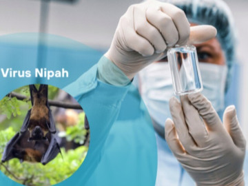 Tin tức - [Infographic] - 5 điều cần lưu ý để phòng bệnh do virus Nipah