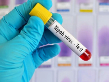 Sức khỏe - Thông tin mới nhất về bệnh do virus Nipah tại Việt Nam