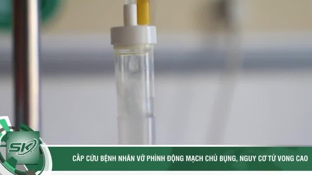 Giành giật sự sống cho bệnh nhân vỡ phình động mạch chủ bụng, nguy cơ tử vong cao