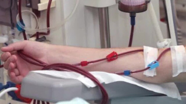 Sai lầm trong thói quen uống cà phê khiến người đàn ông suy thận mạn