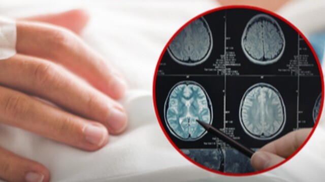 Đột ngột đau đầu dữ dội khi đang tắm, người phụ nữ phải cấp cứu