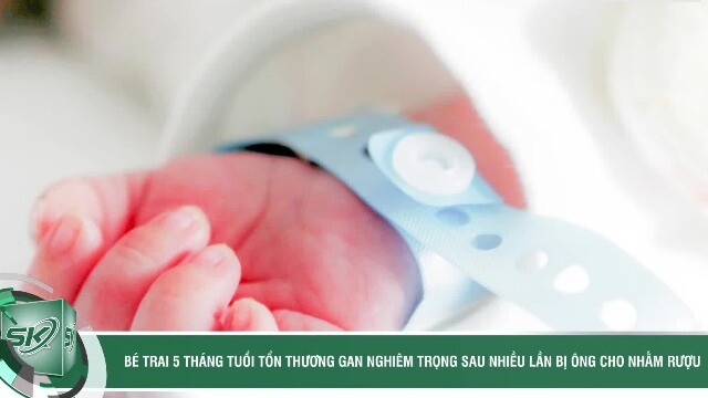 Bé trai 5 tháng tuổi tổn thương gan nghiêm trọng sau nhiều lần bị ông cho nhấm rượu