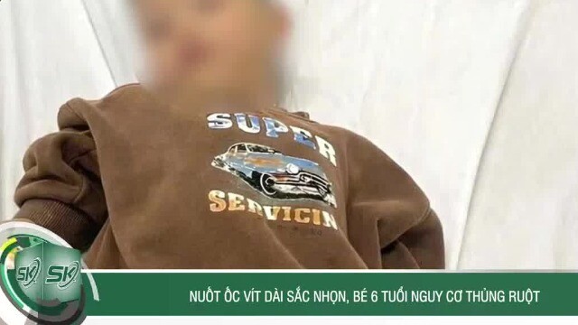 Nuốt ốc vít dài sắc nhọn, bé 6 tuổi nguy cơ thủng ruột