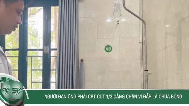 Người đàn ông phải cắt cụt 1/3 cẳng chân vì đắp lá chữa bỏng