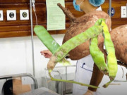 Clip Eva - Tình trạng sức khỏe 6 người trong gia đình nhập viện vì ngộ độc hạt củ đậu