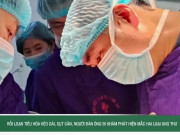 Clip Eva - Rối loạn tiêu hóa kéo dài, sụt cân, người đàn ông đi khám phát hiện mắc hai loại ung thư