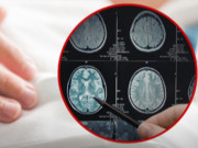 Clip Eva - Đột ngột đau đầu dữ dội khi đang tắm, người phụ nữ phải cấp cứu