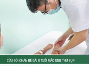 Clip Eva - Cứu đôi chân bé gái 8 tuổi mắc ung thư sụn