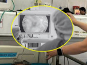 Clip Eva - Sốt kéo dài hai tuần, bé trai nhiễm vi khuẩn hiếm khiến ruột thủng hơn 30 lỗ