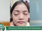 Clip Eva - Ngỡ lồi mắt do cường giáp, người phụ nữ suýt hỏng mắt vì phát hiện u nhầy xoang sàng khổng lồ