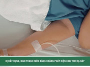 Clip Eva - Thường xuyên đầy bụng, nam thanh niên bàng hoàng phát hiện ung thư dạ dày giai đoạn cuối