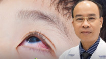 Những bệnh mắt trẻ nhỏ hay gặp nhưng cha mẹ dễ chủ quan