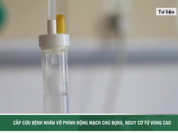 Giành giật sự sống cho bệnh nhân vỡ phình động mạch chủ bụng, nguy cơ tử vong cao