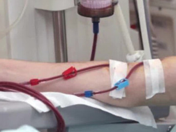 Sai lầm trong thói quen uống cà phê khiến người đàn ông suy thận mạn