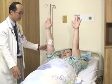 Đau đầu kéo dài và sụp mí mắt, cô gái bàng hoàng phát hiện bị đột quỵ tuyến yên