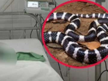 Bé gái 7 tuổi thoát cửa tử sau khi bị rắn cạp nia cắn lúc ngủ