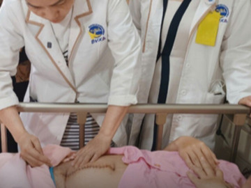 Cứu sản phụ và thai nhi khỏi nguy kịch do nhau cài răng lược trên vết mổ lấy thai cũ