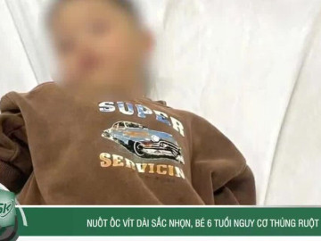 Nuốt ốc vít dài sắc nhọn, bé 6 tuổi nguy cơ thủng ruột