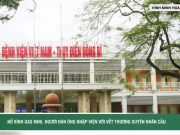 Người đàn ông nhập viện với vết thương xuyên nhãn cầu do bình gas mini phát nổ