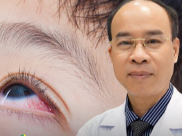 Những bệnh mắt trẻ nhỏ hay gặp nhưng cha mẹ dễ chủ quan