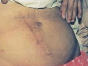 Bà bầu - Sản phụ tự sinh con tại nhà, con trai 8 tuổi chính là người đỡ đẻ