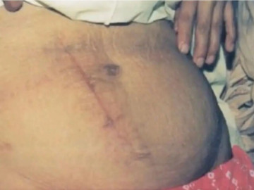 Bà bầu - Sản phụ tự sinh con tại nhà, con trai 8 tuổi chính là người đỡ đẻ