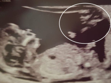 Bà bầu - Sảy thai 5 lần, nữ diễn viên bất lực tìm con thì nhận phép màu từ người chồng đã mất 10 năm