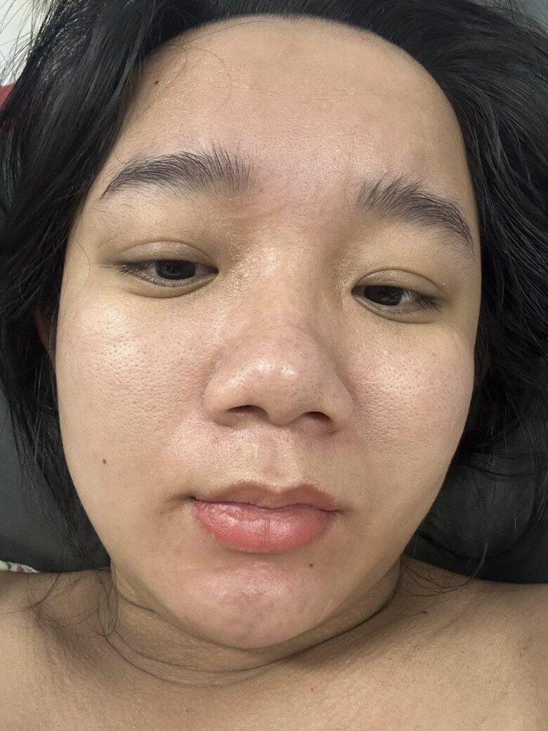 Gái Việt 2k4 mặt mộc xinh như hot girl, giờ có bầu nhan sắc biến dạng gây choáng, tự nhận già đi 20 tuổi - 5