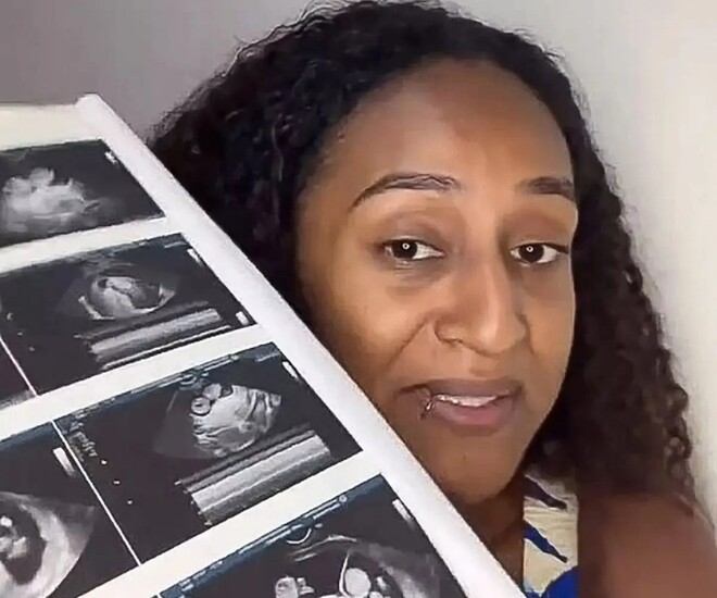 Bà mẹ trẻ sốc khi phát hiện mang bầu đôi dù mới sinh con không lâu.