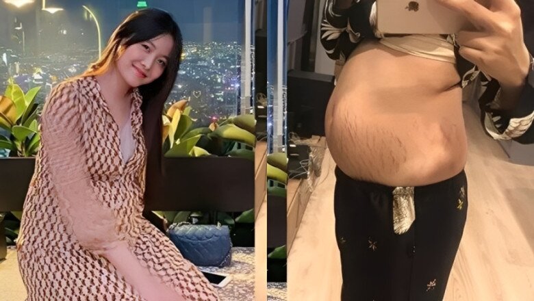 Mẹ hai con khoe bụng chằng chịt vết rạn sau hành trình bầu bí, sinh nở.