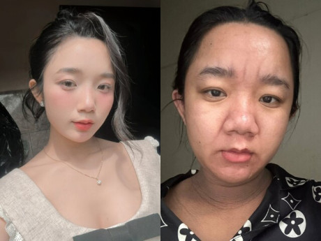 Bà bầu - Gái Việt 2k4 mặt mộc xinh như hot girl, giờ có bầu nhan sắc biến dạng gây choáng, tự nhận già đi 20 tuổi