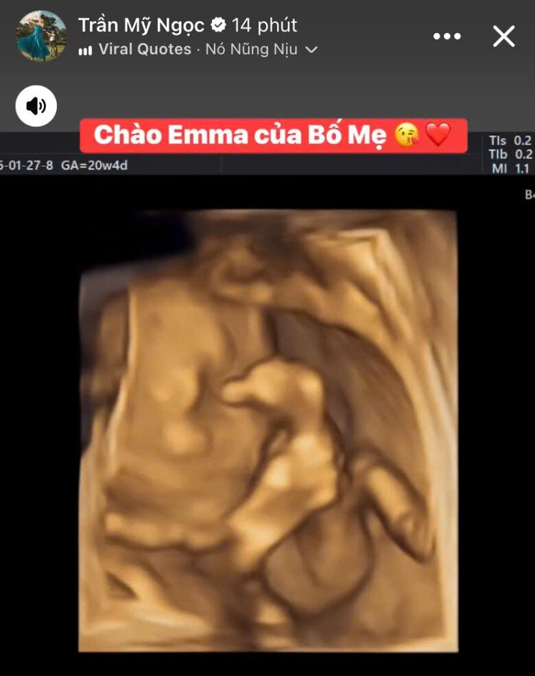 MC, ca sĩ Mỹ Ngọc mang bầu lần 2 ở tuổi 37.