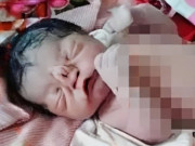 Bà bầu - Tái mặt vì con mới sinh ngoại hình khác lạ, bác sĩ nói nguyên nhân bố mẹ ôm nhau khóc