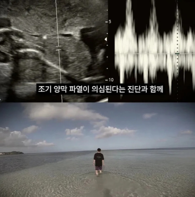 Cặp đôi ghi lại những khoảnh khắc đáng nhớ trong thai kỳ và xem đó là kỷ niệm đẹp trong đời.