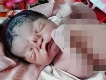 Bà bầu - Tái mặt vì con mới sinh ngoại hình khác lạ, bác sĩ nói nguyên nhân bố mẹ ôm nhau khóc