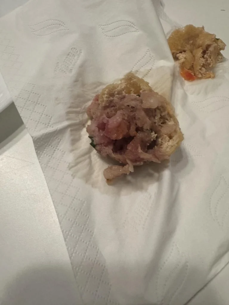 Cô giáo yoga nổi tiếng mang bầu 8 tháng vô tình ăn phải thịt lợn sống, lập tức làm một hành động được bác sĩ khen - 4