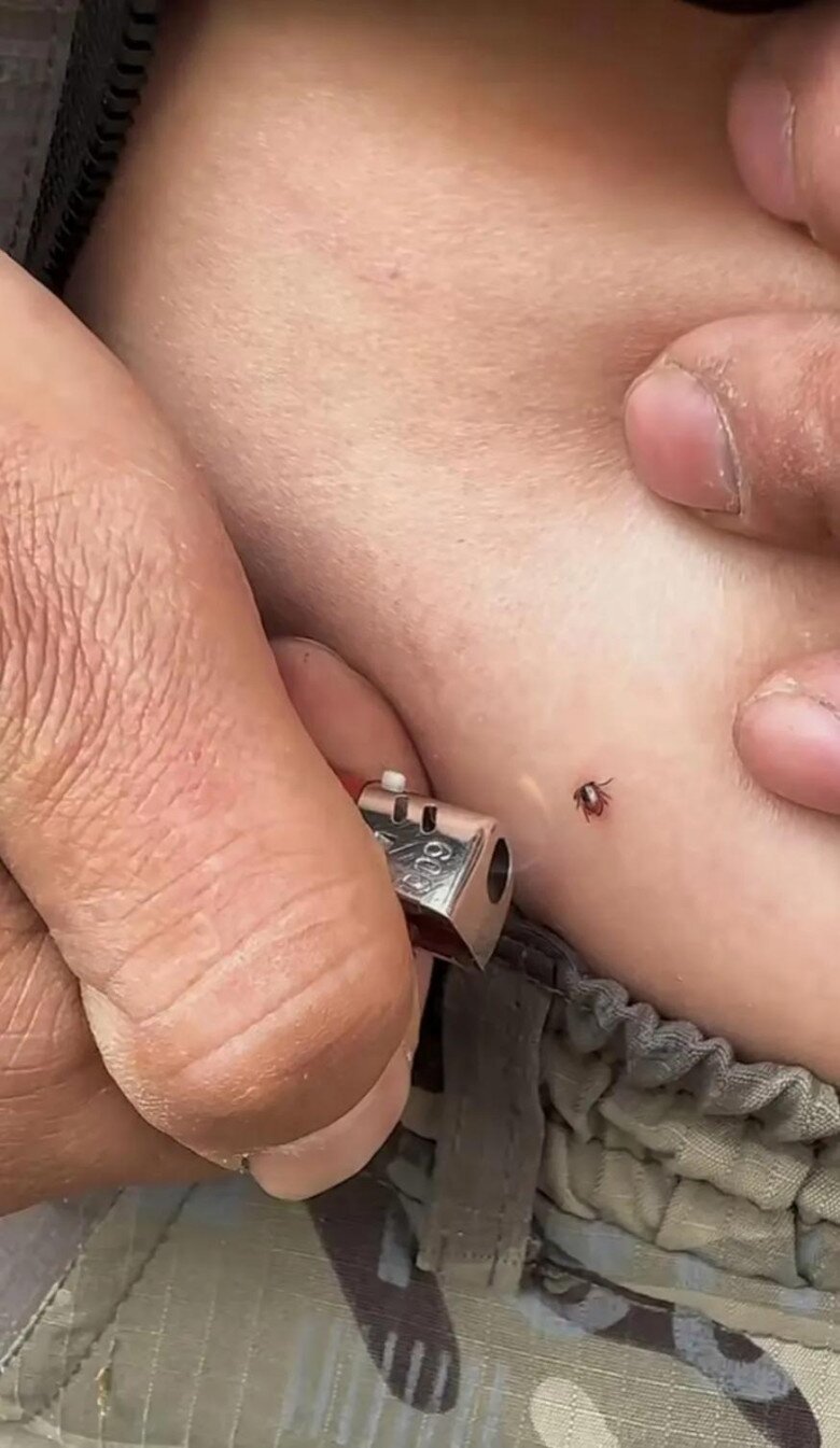 Con gái bị sinh vật lạ cắn vào cổ, bố 2 lần muốn cứu nhưng mẹ từ chối, bác sĩ khen: Mẹ đúng! - 2