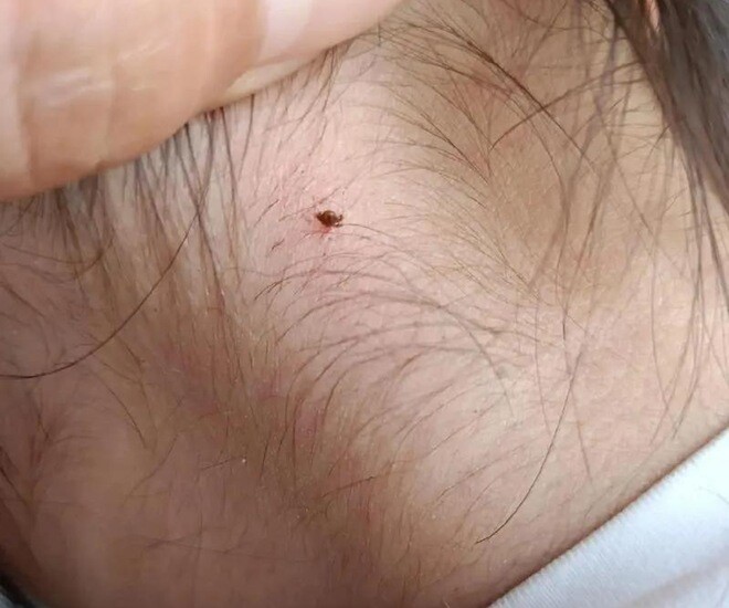 Xem thêm video: bé gái 8 tuổi ở Bình Thuận đu lên cửa cuốn, bị cuộn toàn thân đưa lên cao, hôn mê