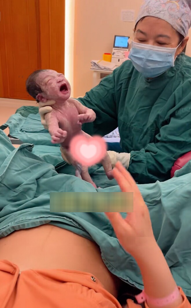 Bé sơ sinh chào đời khóc suốt không thể dỗ, cảnh tượng lúc đưa lại gần mẹ khiến ai cũng khó tin - 2