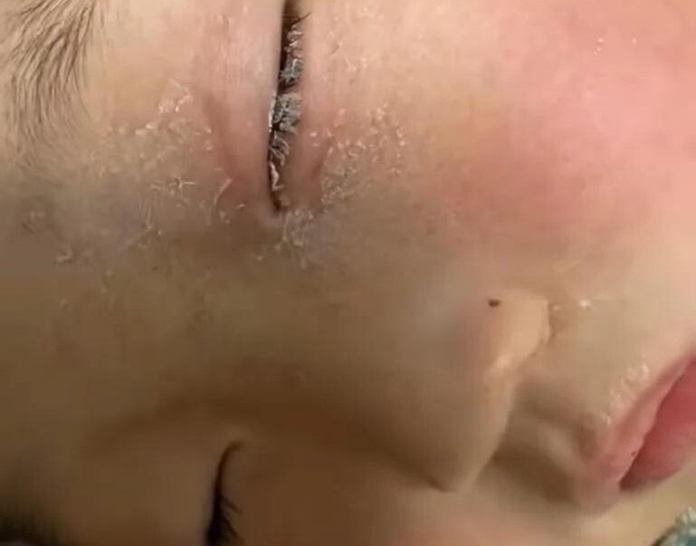 Con bị keo 502 bắn vào mắt, bố nhẹ nhàng đổ thêm một thứ, bác sĩ khen: Hiếm có người thông minh như anh! - 3