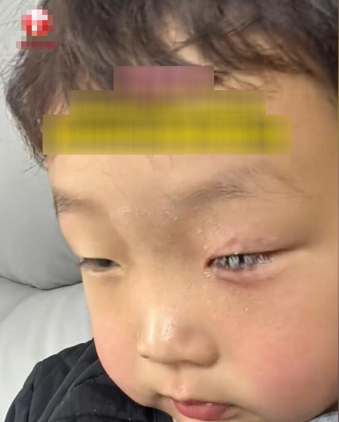 Con bị keo 502 bắn vào mắt, bố nhẹ nhàng đổ thêm một thứ, bác sĩ khen: Hiếm có người thông minh như anh! - 4