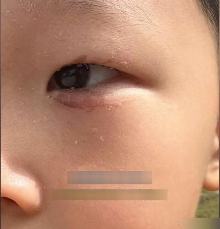 Con bị keo 502 bắn vào mắt, bố nhẹ nhàng đổ thêm một thứ, bác sĩ khen: Hiếm có người thông minh như anh! - 5