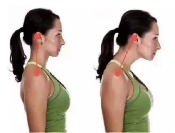 Đứa trẻ lúc nhỏ xinh, càng lớn càng kém sắc vì thói quen này khi ngủ mà nhiều trẻ em hay mắc phải - 6